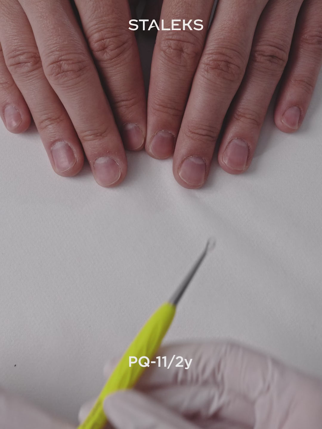 Įkelti vaizdo įrašą: STALEKS UNIQ 11 TYPE 2 Gummy Pusher skošny ir žiedas